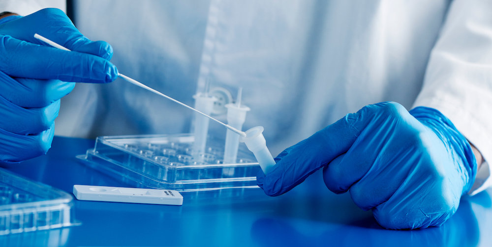 yurtdisina-cikis-icin-pcr-testi